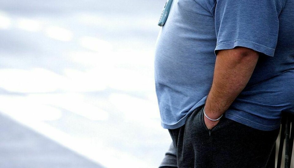ARKIVFOTO af overvægtig mand- – Se RB 12/3 2015 06.15. Flere af os spiser stadig for usundt. Derfor skal vi diskutere vores spisevaner, mener Dan Jørgensen. (Foto: PAUL ELLIS/Scanpix 2015)