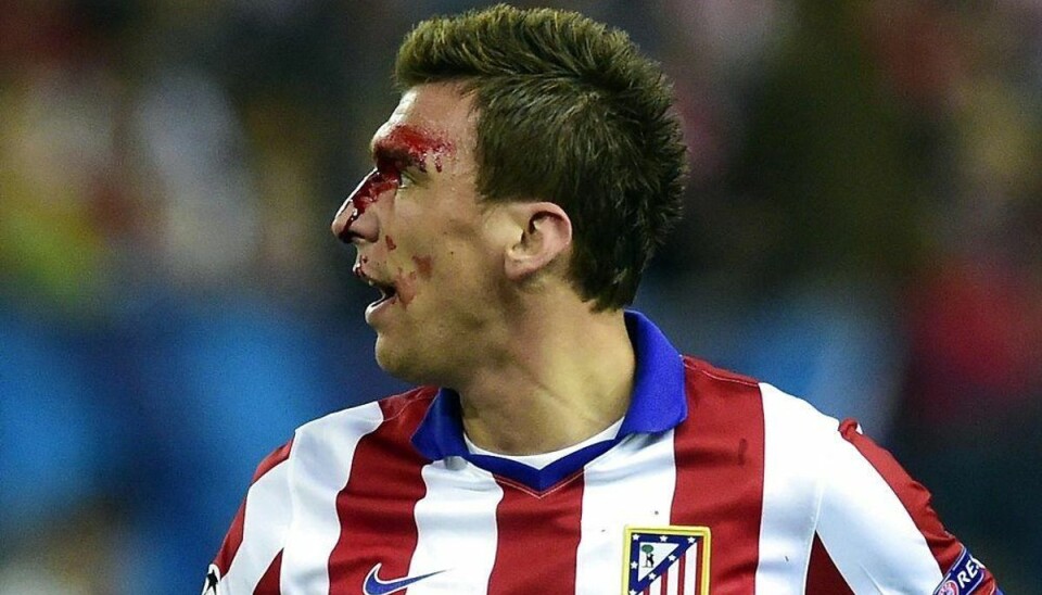 Mandzukic frikender Real-spiller: -Jeg blev ikke bidt Foto: GERARD JULIEN/Scanpix.