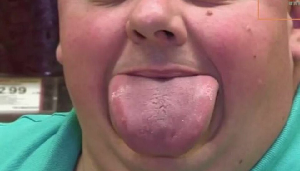 Slurp! Se verdens bredeste tunge
