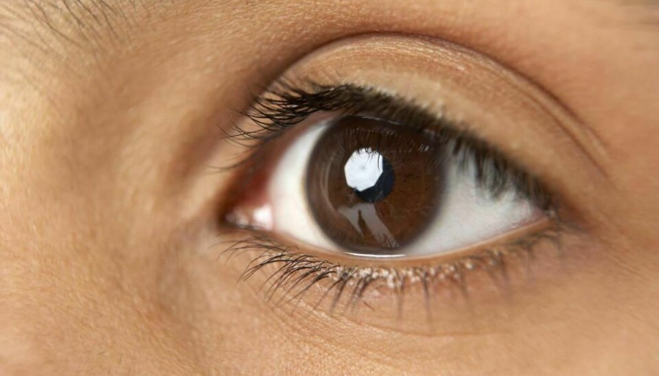 Optikere laver sygdomstjek på danskere. Det vækker bekymring hos blandt andet diabetesforeningen. Foto: Colourbox