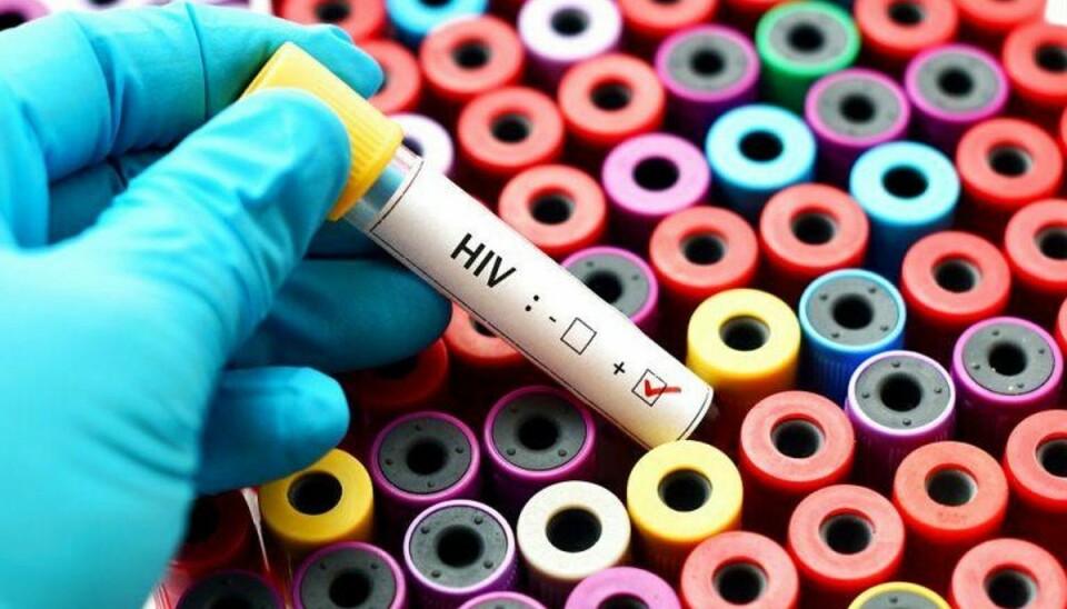 En medarbejder har givet fem patienter HIV ved at skide på protokollerne.Arkivfoto: SCANPIX