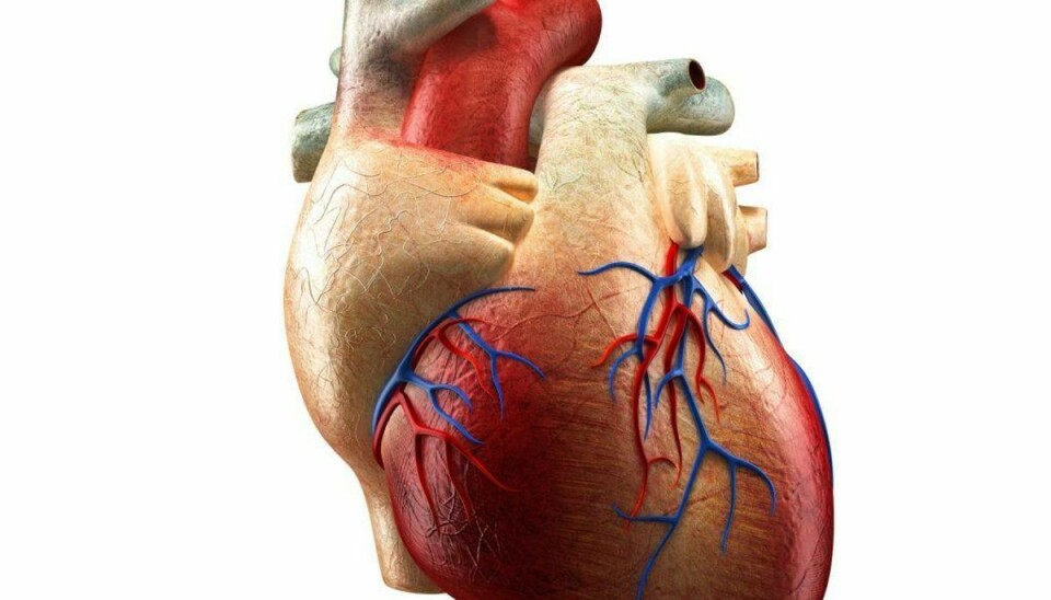 Hjertekarsygdomme dækker over en række forskellige sygdomme og lidelser, herunder blodpropper i hjertet og hjernen samt hjerneblødninger. Fra 1987 til 2000 steg antallet af danskere, der havde en hjertekarsygdom, med 1%. Foto: Scanpix.KLIK VIDERE I GALLERIET OG LÆS OM SYV ANDRE FOLKESYGDOMME
