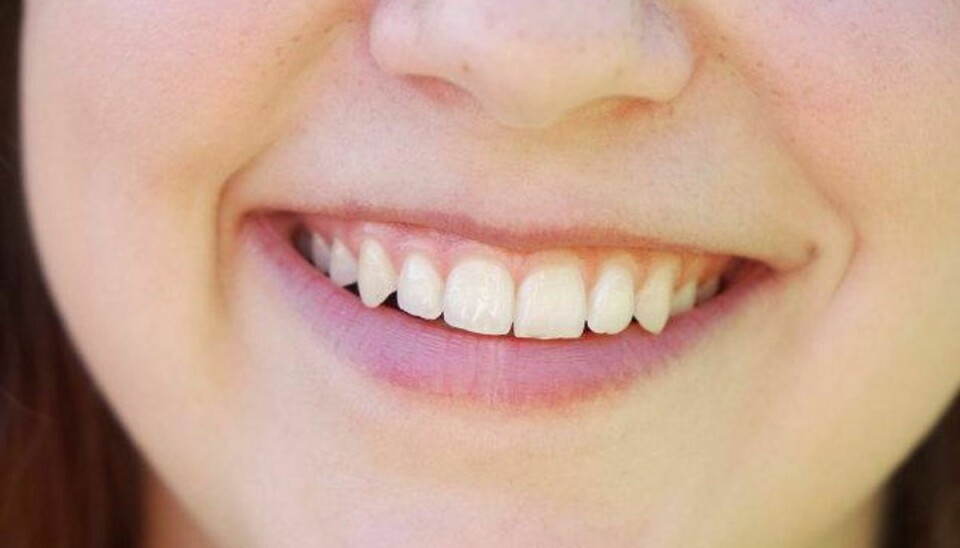 Aktivt kul kan ikke ændre farven på dine tænder, fortæller overtandlæge Ulla Pallesen. Foto: Colourbox/Free