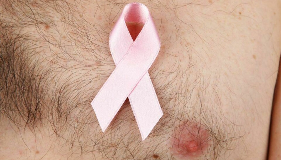 Det nok vigtigste af de kendte symptomer på brystkræft hos mænd, du skal kende, er en knude. Foto: Scanpix.