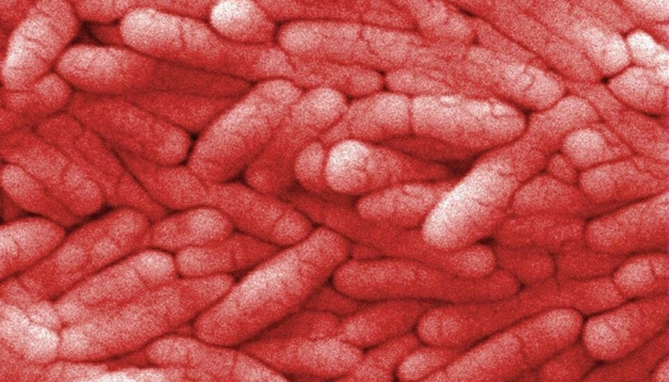 Salmonella bakterier set i mikroskop. Klik videre i galleriet for at se eksempler på typiske smittekilder. Foto: Scanpix.