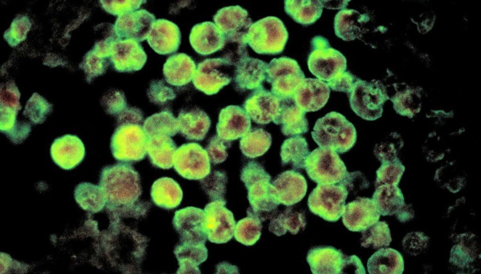Mand død: Inficeret af hjerneædende amøbe Amøben Naegleria fowleri kan slå ihjel. Foto: Scanpix