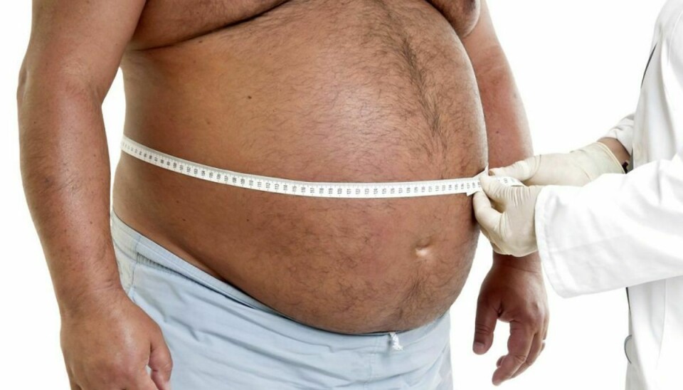 Ifølge fransk ekspert er risikoen for corona-komplikationer dobbelt så stor for overvægtige. Klik videre for flere billeder. Foto: Scanpix.