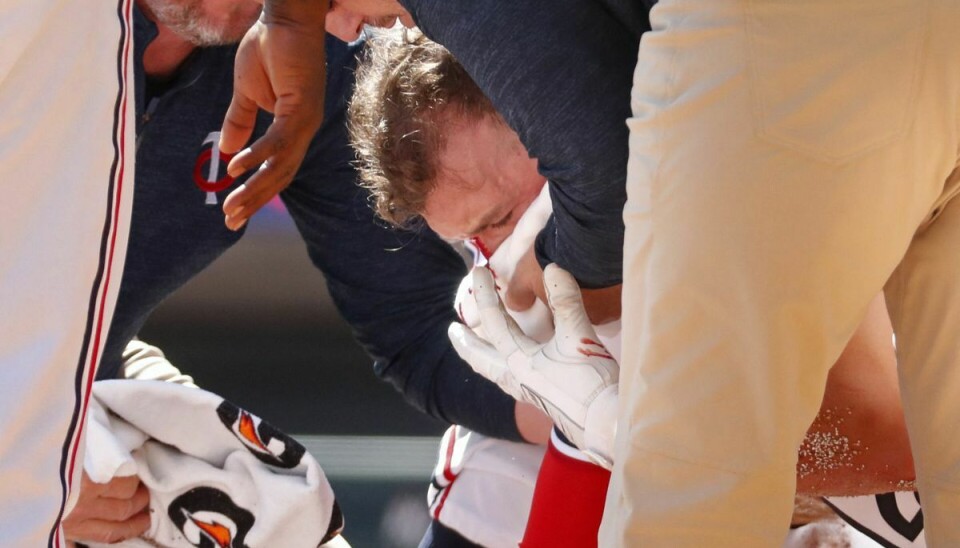 Kyle Farmer blev taget ud af kampen og røg direkte på operationsbordet.