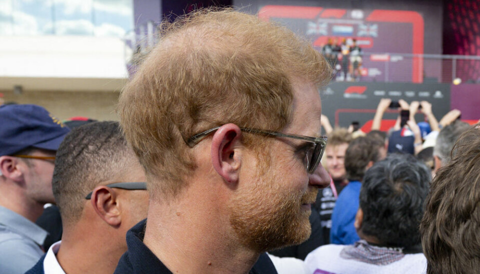 Prins Harry er ved at blive skaldet på toppen som sin far og storebror, men det skyldes ikke kun gener, mener ekspert.