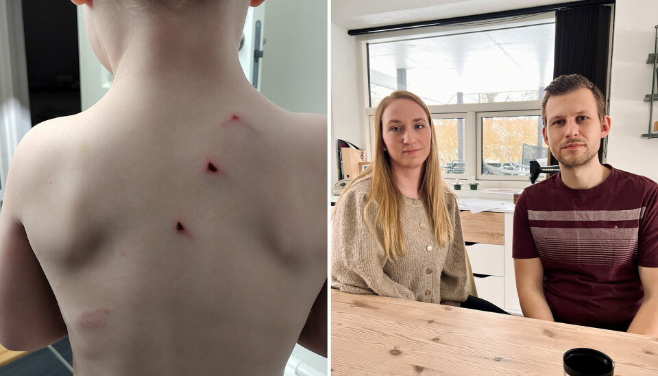 Camilla Himmelstrup og Philips Sørensens tre-årige søn fik efter et overfald i Fussingø Naturbørnehave store røde sår hen over ryggen.