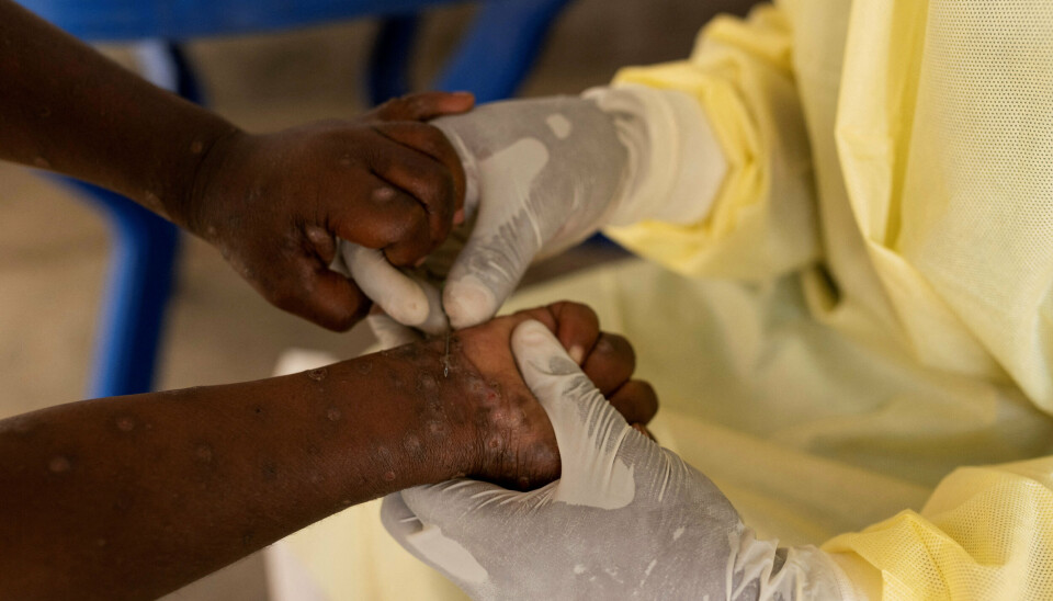 Der har siden begyndelsen af 2024 været et udbrud af mpox i Den Demokratiske Republik Congo (DR Congo), som siden har spredt sig til nabolande. (Arkivfoto).