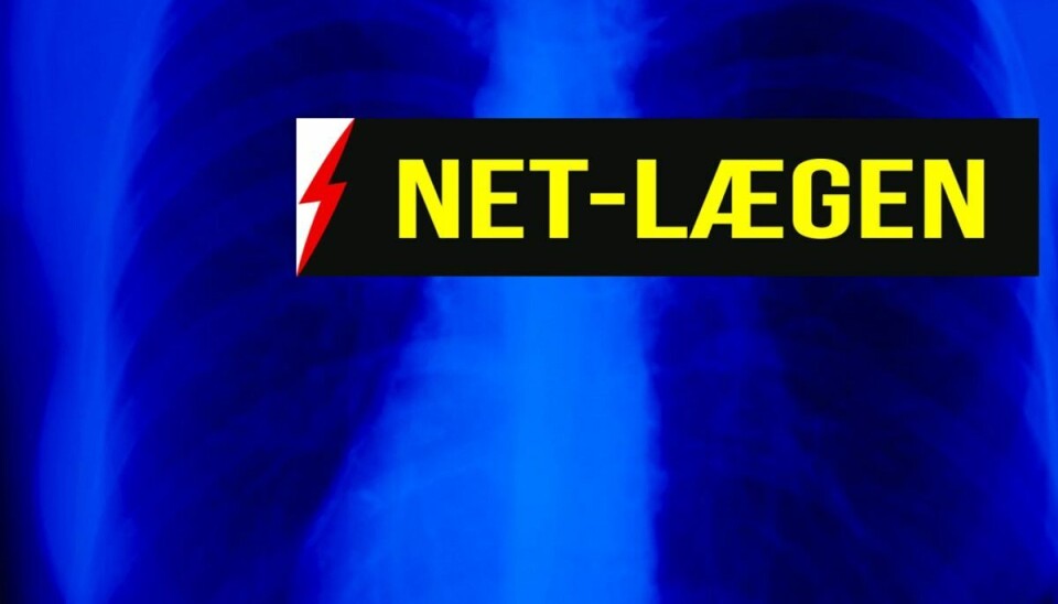 Newsbreak.dks Netlæge skriver i denne uge som Lungefibrose - en sygdom, der omdanner lungevævet til arvæv. Newsbreak.dks Netlæge skriver i denne uge som Lungefibrose - en sygdom, der omdanner lungevævet til arvæv.