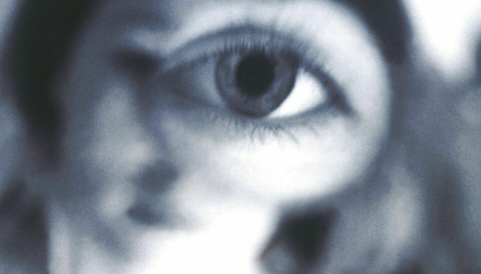 Arkivfoto: En læge i Californien måtte fjerne adskillige kontaktlinser fra en glemsom patients øjenlåg.
