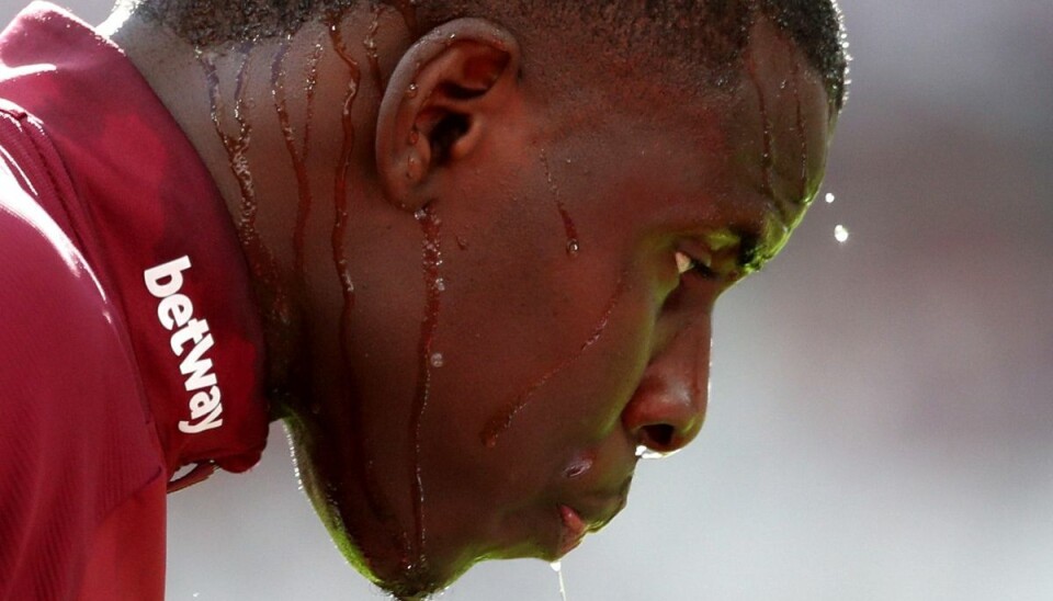 Kurt Zouma er kommet i vælten, efter at en video af ham, der mishandler sin kat, er gået viralt. (Arkivfoto)