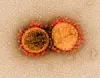 En virus i coronavirus-familien. Foto: Scanpix