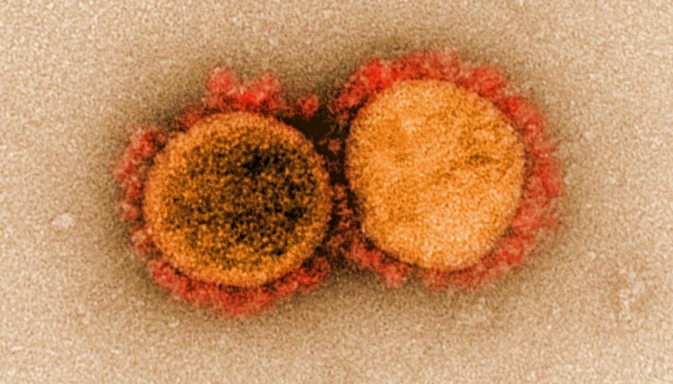 En virus i coronavirus-familien. Foto: Scanpix