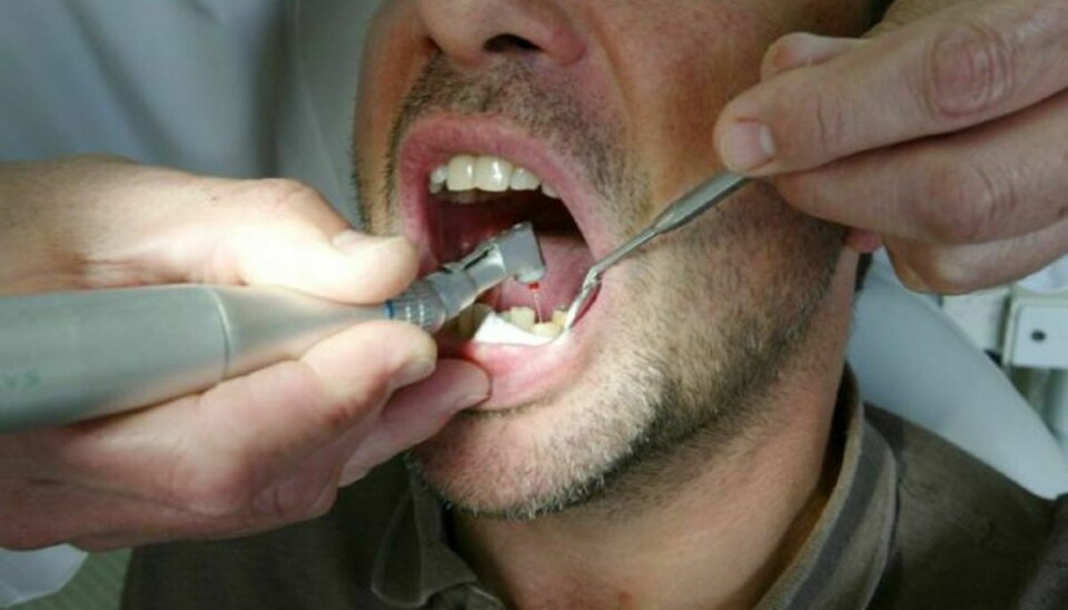 Ved nogle huller skal der ikke andet end simpel børstning til. Alligevel finder mange tandlæger hurtigt boret frem. Arkivfoto. Foto: Colourbox/COLOURBOX.COM